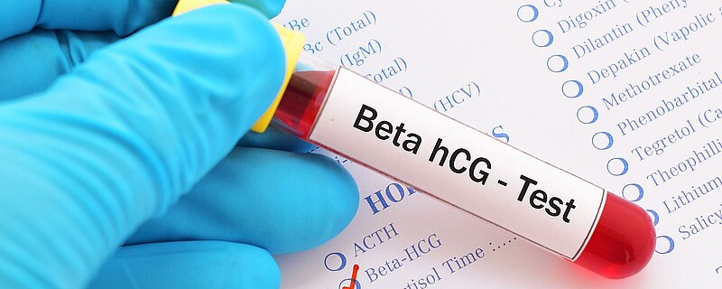Poziom beta hcg po poronieniu i kiedy kolejna ciąża