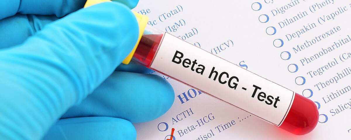 Poziom beta hcg po poronieniu i kiedy kolejna ciąża