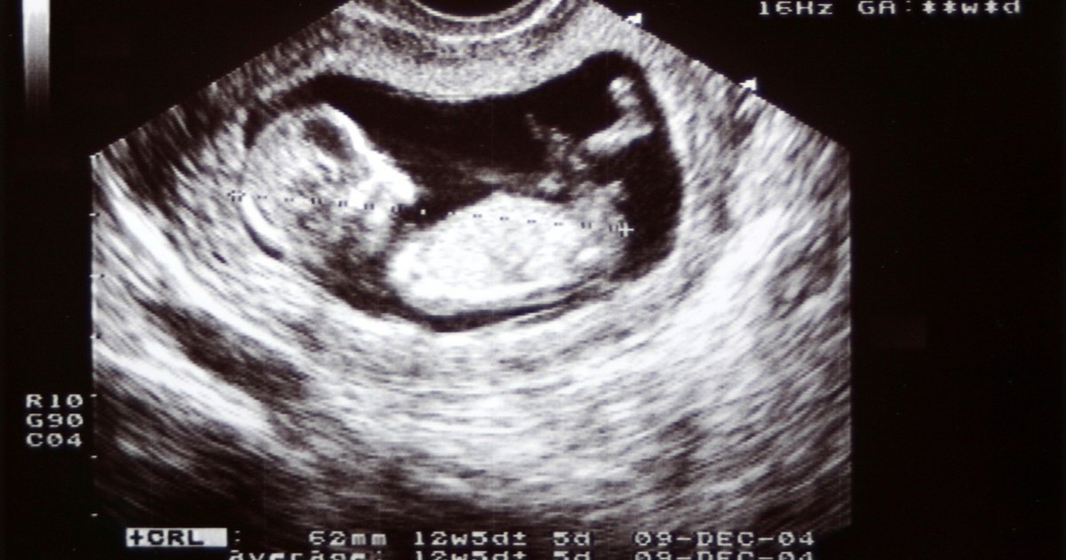 alias Tilladelse Forudsige 12 tydzień ciąży - twój brzuszek już jest widoczny? Kalendarz ciąży