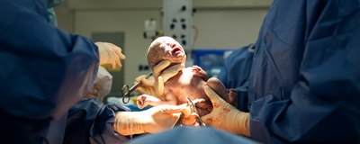 Nacinanie krocza podczas porodu